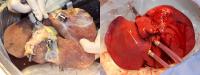 Liver