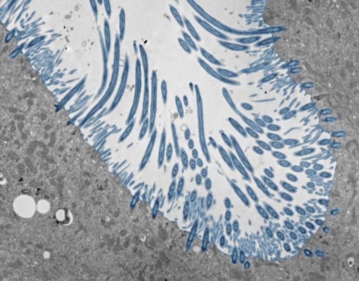 Human nasal organoids with cilia