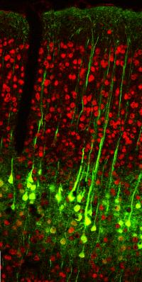 Apical Dendrites In Cortex