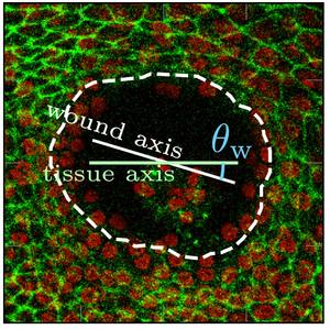 Image to illustrate the wound structure/tissue axis