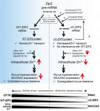 Intracellular Zinc / Mucus Production and Progress Mechanism of Obstructive Pulmonary Disease