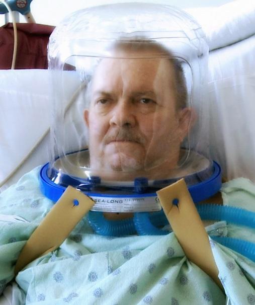Study Patient Receiving Non-Invasive Ventilation Using the Helmet