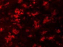 OTC Staining