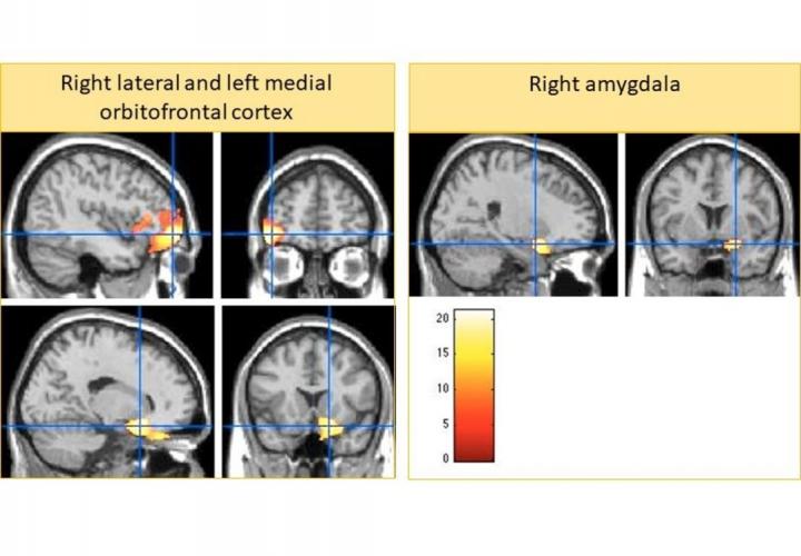 Brain MRI