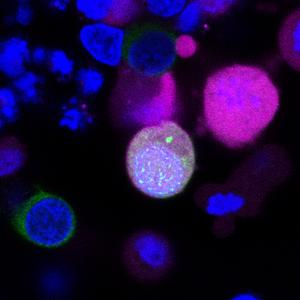 Meiotic features in iPSC-derived cells