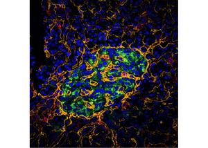 Scripps Research scientists awarded $1.1 million to advance AI modeling for HIV vaccine development