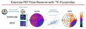Exercise/rest measurements of the standardized uptake value ratio (SUVR) are used with an exponential calibration function to estimate myocardial flow reserve (MFR).