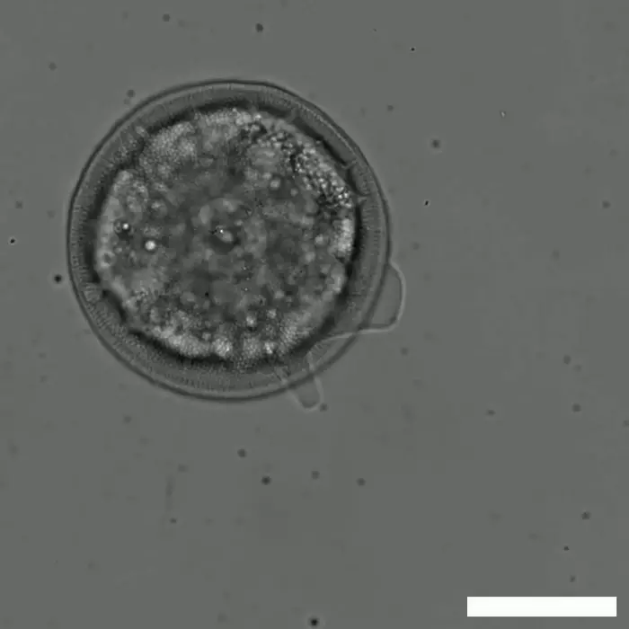Microscopic Movement of Arcella on Glass