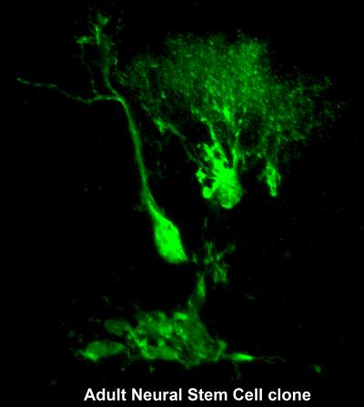 Stem Cell