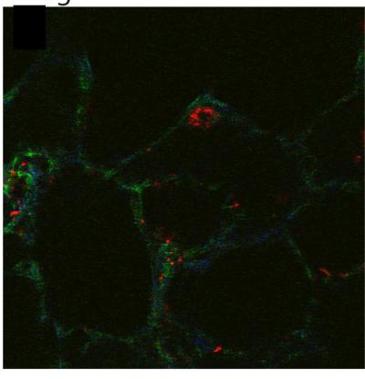 Molecular Probes Fibronectin Strain Lung Tissue
