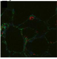 Molecular Probes Fibronectin Strain Lung Tissue