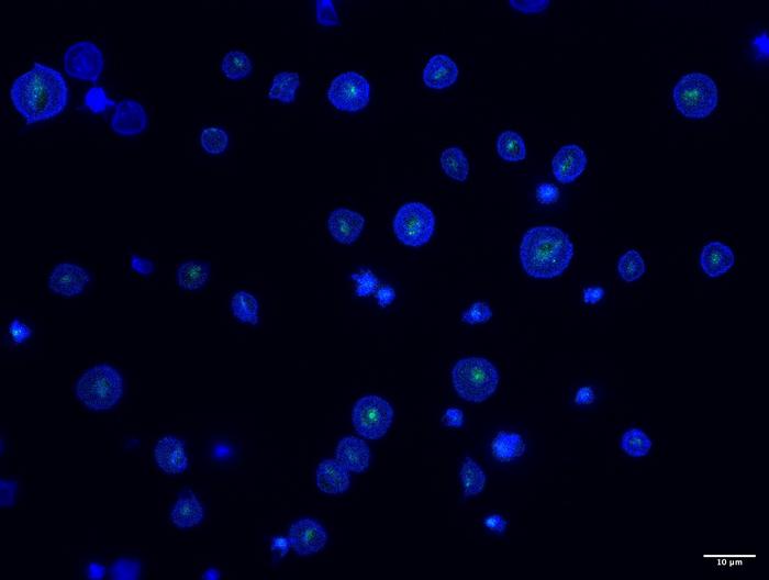 Reticulated Platelets