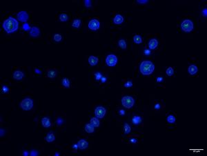 Reticulated Platelets