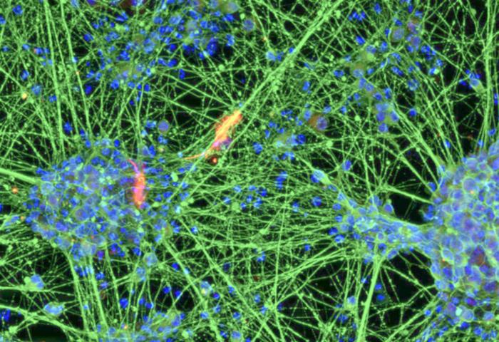 Researchers transform old blood cells into young brain cells | EurekAlert!