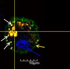 Cellular Trojan Horse Yields Potential Cancer Treatment