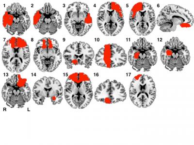 Lesions