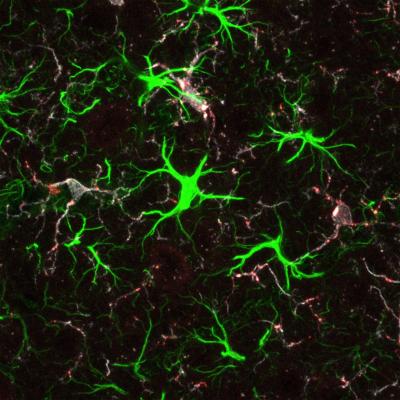 Reactive Glia