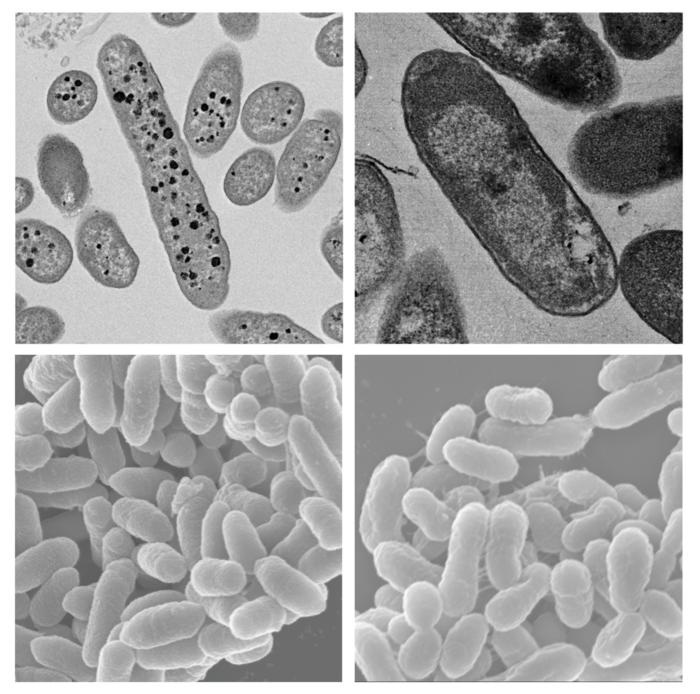 Two bacteria responsible for bacterial constipation