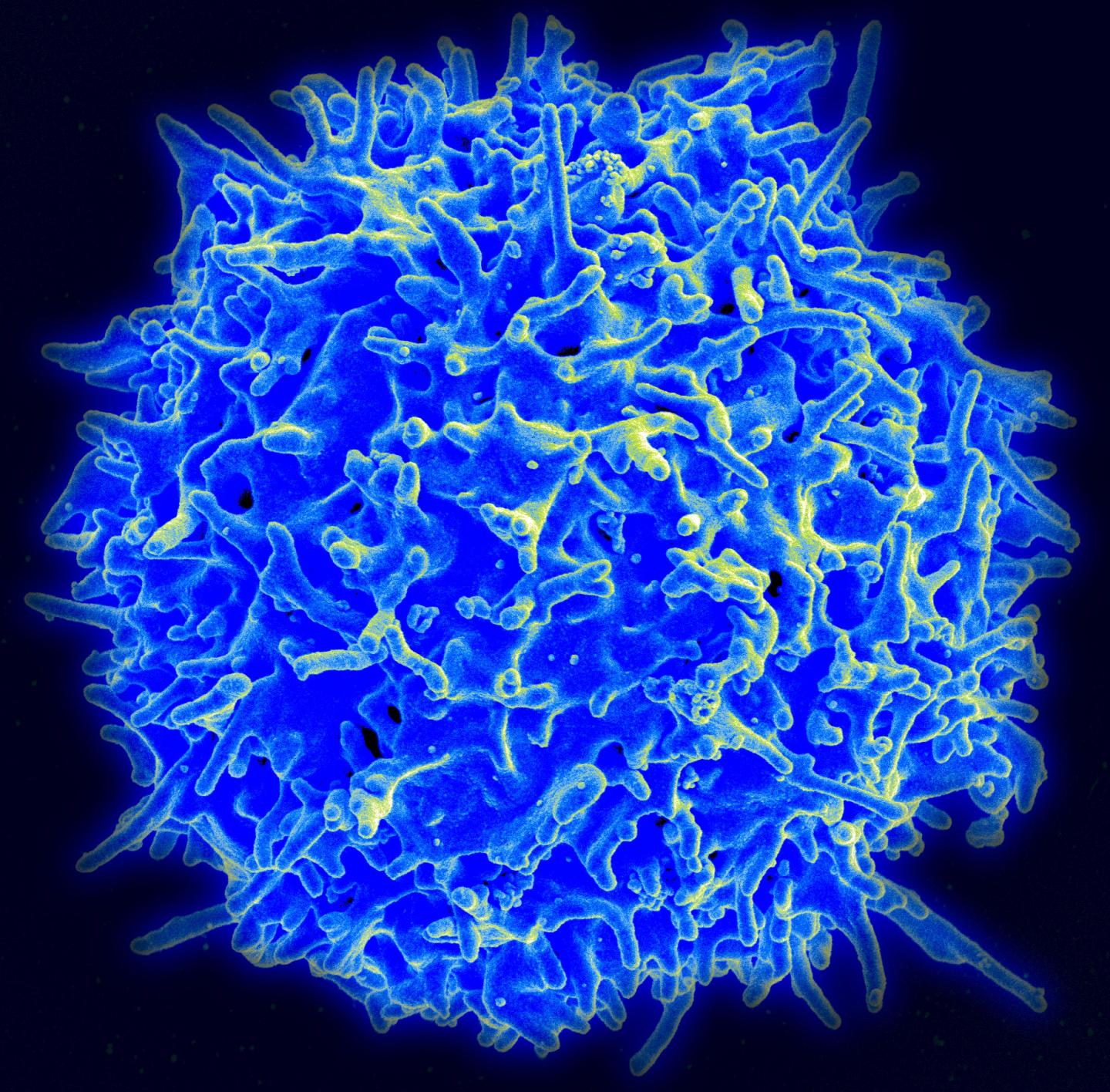 Immune System May Wage a Battle in Brain Disorders