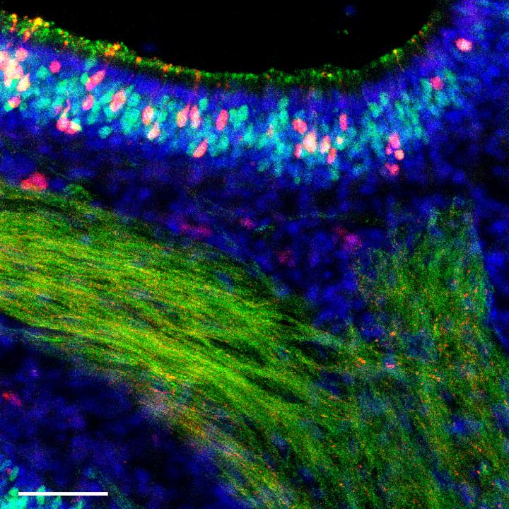 Olfactory Neurons