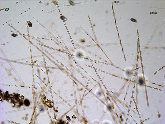 Pseudo-nitzschia