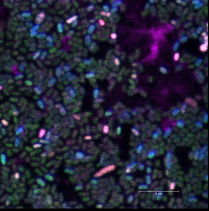 Biofilm