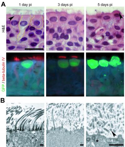 PIV NS2 Infection
