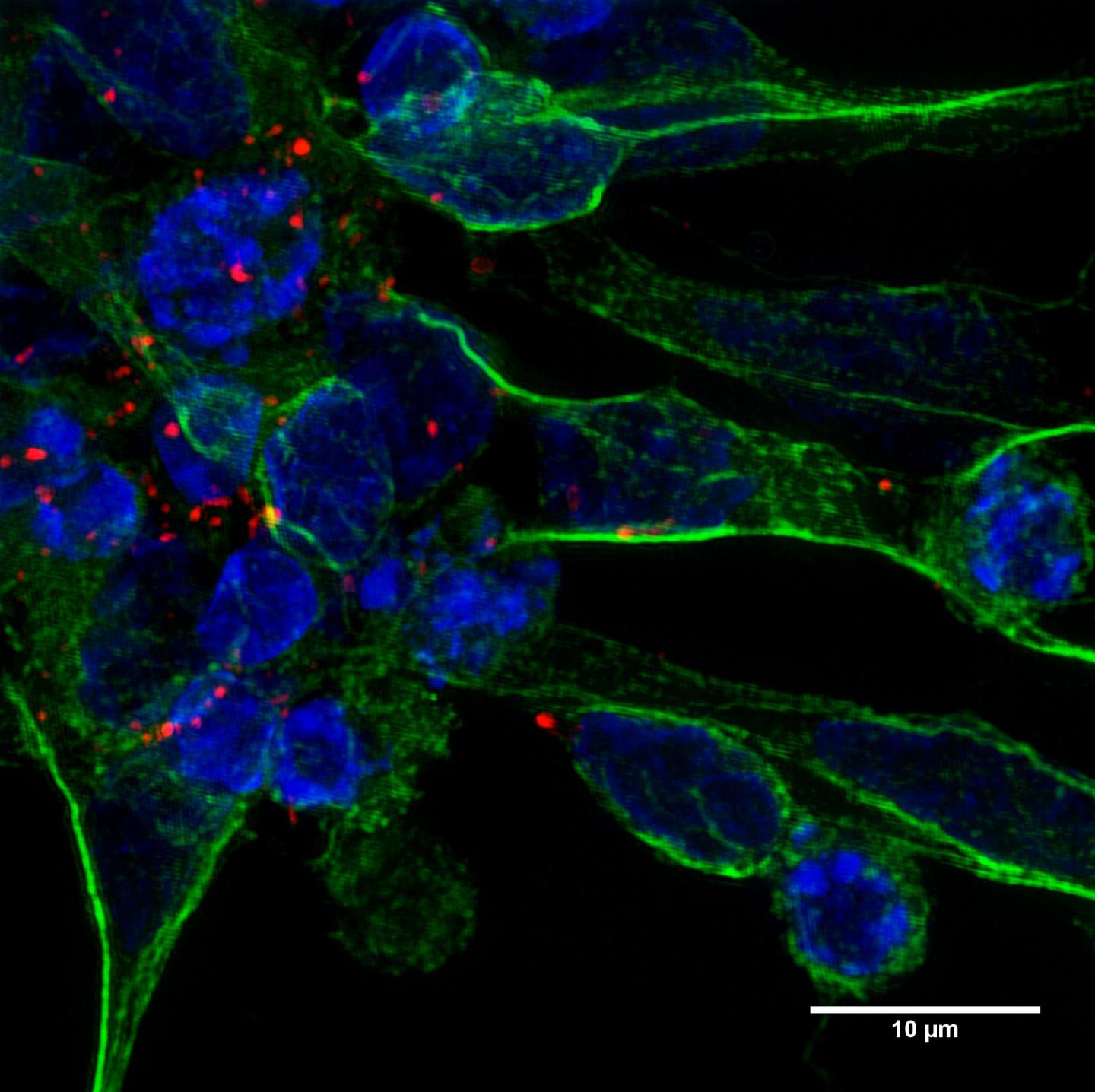 Exosome