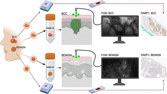 PARPi-FL fluorescent confocal microscopy imaging for BCC detection.
