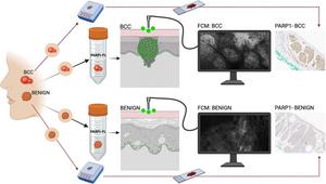 PARPi-FL fluorescent confocal microscopy imaging for BCC detection.