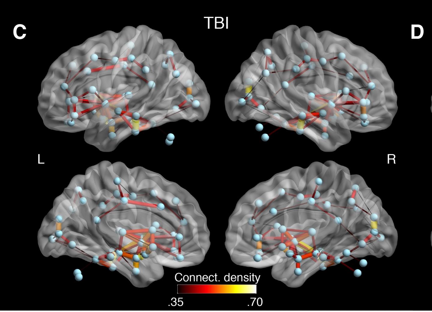 Brain Connections