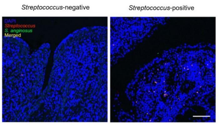 Levels of oral bacteria