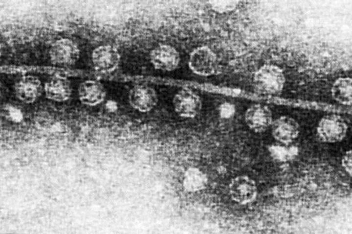 Study Finds Vast Diversity among Viruses that Infect Bacteria