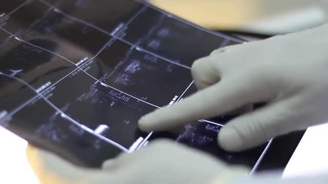 Machine Learning Techniques Generate Clinical Labels of Medical Scans