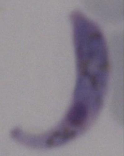 Mutant Malaria Parasite