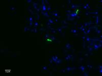 Visualizing Cells From The Candidate Phylum Kryptonia