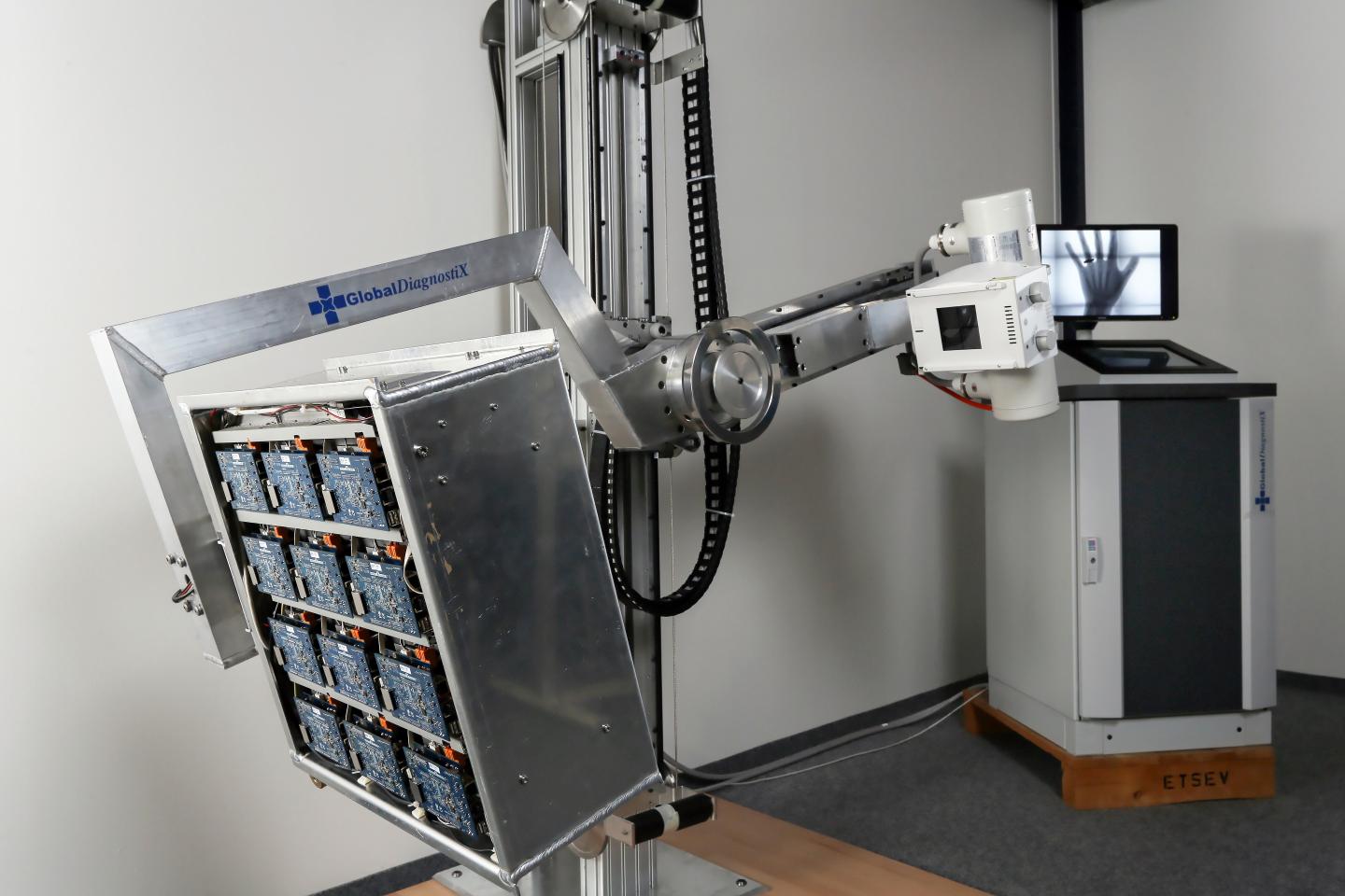 GlobalDiagnostiX, X-Ray for Developing Countries (3 of 3)