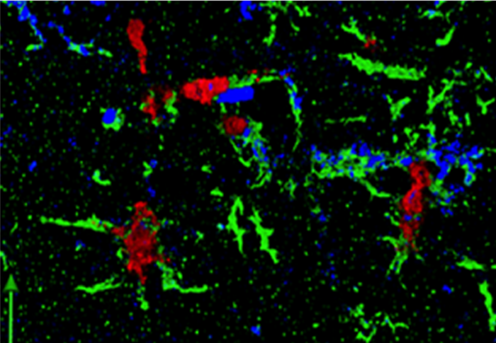 SIV in microglia