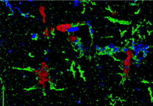SIV in microglia