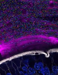 <i>Bacteroides</i> Species in the Mouse Gut