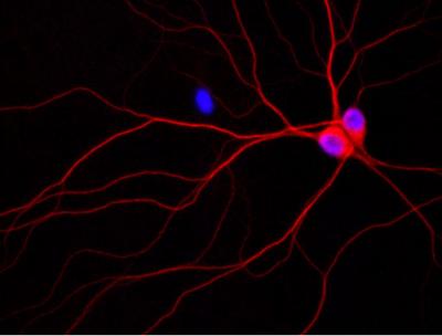 Rat Neurons Growing in a Culture Dish