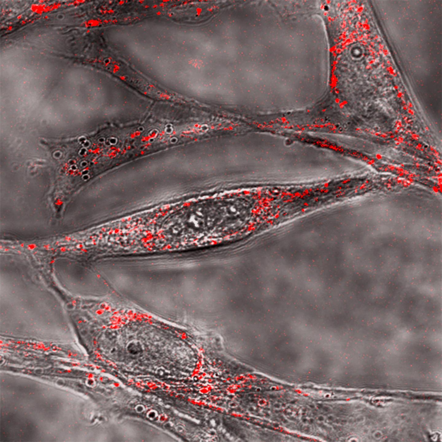Amyloid Beta