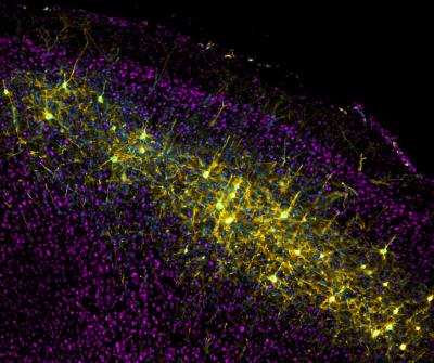 Neuron
