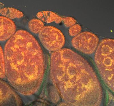 Mitochondria