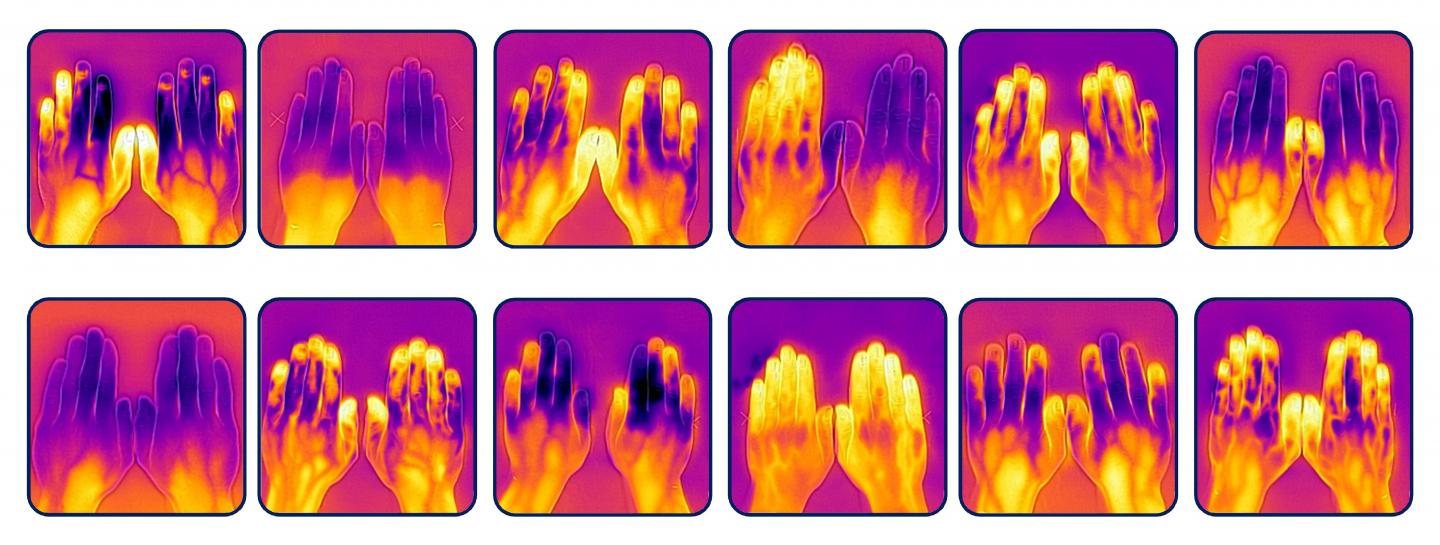 Hand Variation