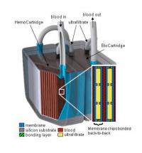 Model: Pmplantable Bioartificial Kidney Developed at the University of California - San Francisco