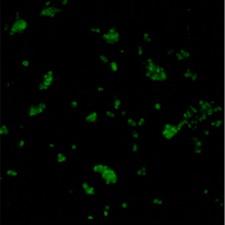 Cancerous Cells