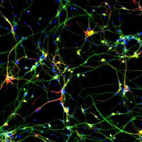 Neurons, 2 Weeks
