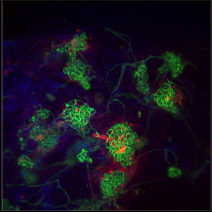 Transplanted Islet Cells
