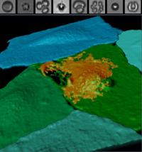 The UPMC Cam used to Explore Gene Therapy via Ultrasound